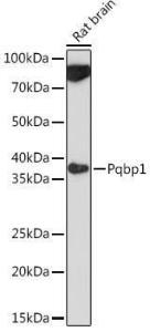 Western blot analysis of extracts of Rat brain, using Anti-Pqbp1 Antibody (A305711) at 1:1000 dilution. The secondary Antibody was Goat Anti-Rabbit IgG H&L Antibody (HRP) at 1:10000 dilution.