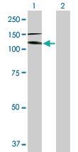 Anti-IL17RA Mouse Polyclonal Antibody