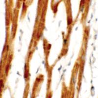 Anti-FCHO2 Rabbit Polyclonal Antibody