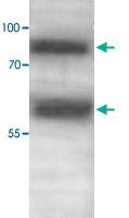 Anti-ADAMTS1 Rabbit Polyclonal Antibody