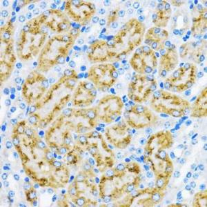 Immunohistochemistry analysis of paraffin-embedded mouse kidney using Anti-EEA1 Antibody (A12659) at a dilution of 1:100 (40x lens). Perform microwave antigen retrieval with 10 mM PBS buffer pH 7.2 before commencing with IHC staining protocol.