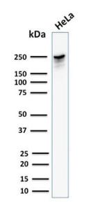 Anti-beta III Spectrin Mouse Monoclonal Antibody [clone: SPTBN2/1582]