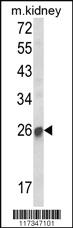 Anti-SOCS1 Rabbit Polyclonal Antibody