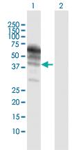 Anti-KNG1 Rabbit Polyclonal Antibody