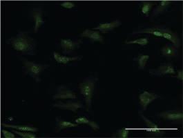 Anti-PDE5A Mouse Monoclonal Antibody [clone: 1F11]