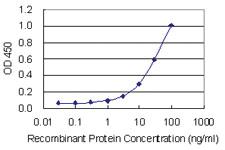 Anti-CRACR2B Mouse Monoclonal Antibody [clone: 2F10]