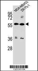 Anti-ABCG4 Rabbit Polyclonal Antibody (AP (Alkaline Phosphatase))