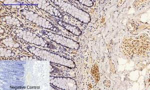 Immunohistochemical analysis of paraffin-embedded human colon tissue using Anti-p53 (phospho Ser15) Antibody at 1:200 (4°C overnight). Negative control was secondary antibody only