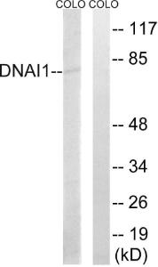 Western blot analysis of lysates from COLO cells using Anti-DNAI1 Antibody. The right hand lane represents a negative control, where the antibody is blocked by the immunising peptide