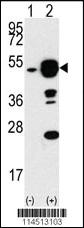 Anti-APP Rabbit Polyclonal Antibody