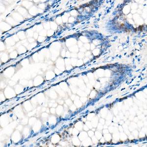 Immunohistochemistry analysis of paraffin-embedded human liver (negative control sample) using Anti-YAP1 Antibody [ARC53477] (A308258) at a dilution of 1:200(40x lens)