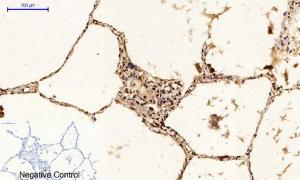 Immunohistochemical analysis of paraffin-embedded human lung tissue using Anti-p53 (phospho Ser15) Antibody at 1:200 (4°C overnight). Negative control was secondary antibody only