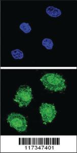 Anti-SOCS1 Rabbit Polyclonal Antibody