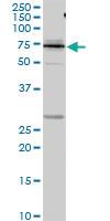 Anti-KNG1 Rabbit Polyclonal Antibody