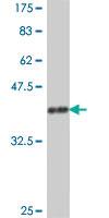 Anti-PARN Mouse Polyclonal Antibody