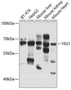 Western blot analysis of extracts of various cell lines, using Anti-Yes1 Antibody (A12663) at 1:1,000 dilution