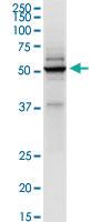 Anti-TRIM21 Polyclonal Antibody Pair