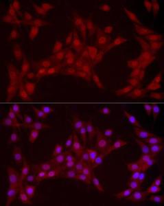 Immunofluorescence analysis of NIH/3T3 cells using Anti-YAP1 Antibody [ARC53477] (A308258) at a dilution of 1:100 (40x lens). DAPI was used to stain the cell nuclei (blue)