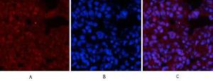 Immunofluorescence analysis of rat lung tissue using Anti-p53 (phospho Ser15) Antibody (red) at 1:200 (4°C overnight). Cy3 labelled secondary antibody was used at 1:300 (RT 50min). Panel A: Target. Panel B: DAPI. Panel C: Merge