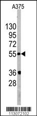 Anti-HLA-DRB4 Rabbit Polyclonal Antibody