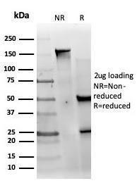 Anti-MED22 Mouse Monoclonal Antibody [Clone: PCRP-MED22-1E4]