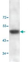 Anti-ADAMTS2 Rabbit Polyclonal Antibody