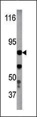 Anti-IKBKB Rabbit Polyclonal Antibody (PE (Phycoerythrin))