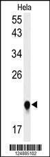 Anti-IMP3 Rabbit Polyclonal Antibody