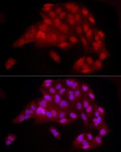 Immunofluorescence analysis of U20S cells using Anti-YAP1 Antibody [ARC53477] (A308258) at a dilution of 1:100 (40x lens). DAPI was used to stain the cell nuclei (blue)