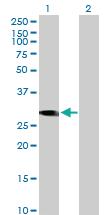 Anti-CCDC88B Mouse Polyclonal Antibody