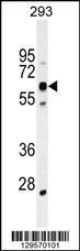 Anti-KRBA2 Rabbit Polyclonal Antibody (HRP (Horseradish Peroxidase))