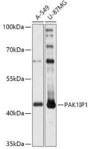 Western blot analysis of extracts of various cell lines, using Anti-PAK1IP1 Antibody (A307251) at 1:1,000 dilution. The secondary antibody was Goat Anti-Rabbit IgG H&L Antibody (HRP) at 1:10,000 dilution.