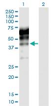 Anti-KNG1 Rabbit Polyclonal Antibody