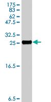 Anti-EMP3 Mouse Polyclonal Antibody