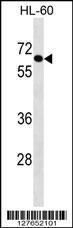 Anti-AIM1L Rabbit Polyclonal Antibody (Biotin)