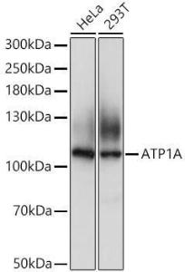 Anti-Sodium Potassium ATPase antibody