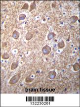 Anti-RASGRP2 Rabbit Polyclonal Antibody