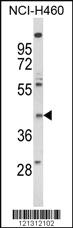 Anti-FPR3 Rabbit Polyclonal Antibody