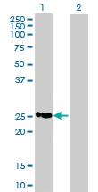 Anti-C19ORF43 Mouse Polyclonal Antibody