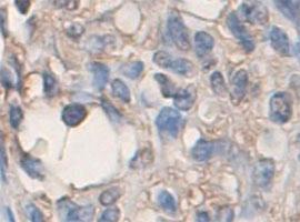 Anti-ADAMTS2 Rabbit Polyclonal Antibody