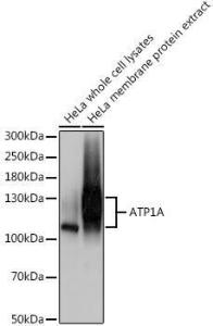 Anti-Sodium Potassium ATPase antibody