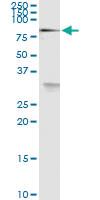 Anti-MEN1 Polyclonal Antibody Pair