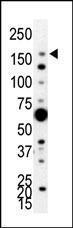 Anti-PIK3C2A Rabbit Polyclonal Antibody (AP (Alkaline Phosphatase))