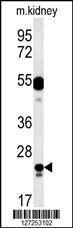 Anti-LYSMD1 Rabbit Polyclonal Antibody (FITC (Fluorescein Isothiocyanate))