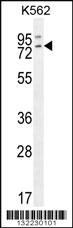 Anti-RASGRP2 Rabbit Polyclonal Antibody