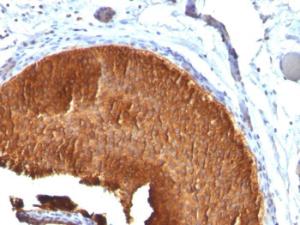 Anti-Cytokeratin 19 antibody