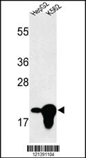 Anti-CHFR Rabbit Polyclonal Antibody