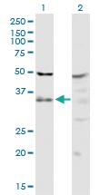 Anti-PIH1D1 Rabbit Polyclonal Antibody