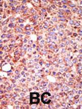 Anti-MGAT3 Rabbit Polyclonal Antibody (FITC (Fluorescein))