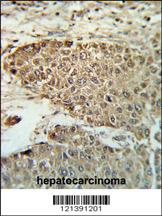 Anti-CHFR Rabbit Polyclonal Antibody